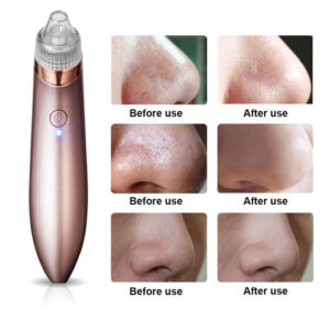 Blackhead Remover Face Acne Black Dot Pimple Cleaner